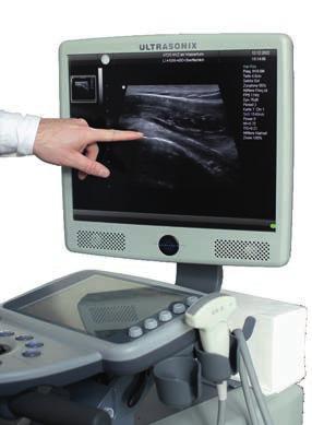 Problemregion Schulter Image 1 Problemregion Schulter Image 1