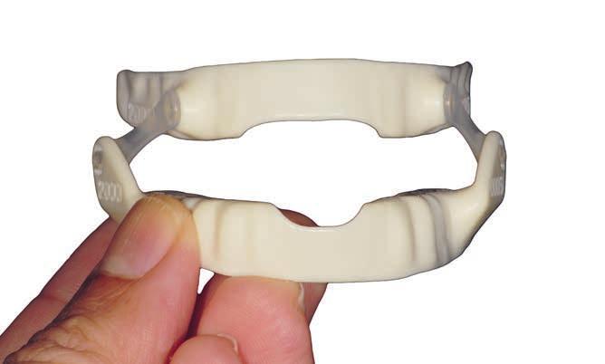 „Eine Schlafapnoe optimal mit einer Unterkiefer-Protrusionsschiene zu behandeln, erfordert genauso medizinische wie zahnmedizinische Kompetenz.“ „Eine Schlafapnoe optimal mit einer Unterkiefer-Protrusionsschiene zu behandeln, erfordert genauso medizinische wie zahnmedizinische Kompetenz.“