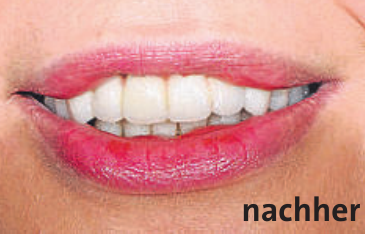 Künstliche Intelligenz in der Zahnheilkunde Image 2 Künstliche Intelligenz in der Zahnheilkunde Image 2