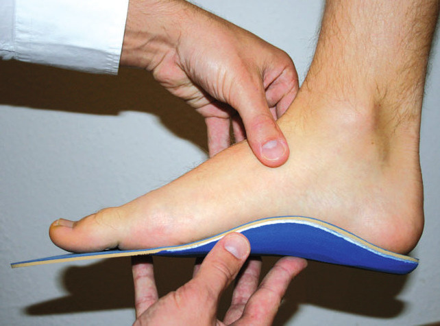 Die Einlagen werden stets ganz individuell dem Fuß und dem Schuhwerk angepasst