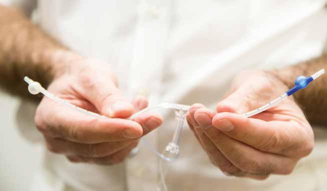 Mit den kleinen Ballons an seinen Enden wird der Shunt sicher in der Halsschlagader verankert. Während der Operation leitet er das Blut ins Gehirn Mit den kleinen Ballons an seinen Enden wird der Shunt sicher in der Halsschlagader verankert. Während der Operation leitet er das Blut ins Gehirn