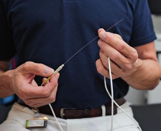 Mit dieser Radiofrequenz- Sonde verödet Dr. Karsten Wiechert Nervenästchen und unterbricht so die Weiterleitung von Schmerzimpulsen. Mit dieser Radiofrequenz- Sonde verödet Dr. Karsten Wiechert Nervenästchen und unterbricht so die Weiterleitung von Schmerzimpulsen.