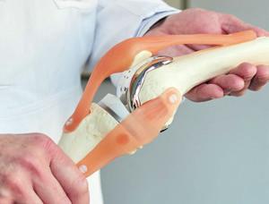 Es muss nicht immer gleich eine Prothese sein Image 2 Es muss nicht immer gleich eine Prothese sein Image 2