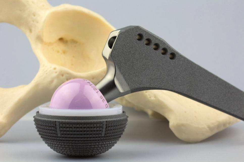 Auch mit „Ersatzteilen“ funktioniert Sport! FOTO: JULIANEMARTENS_FOTOLIA.COM